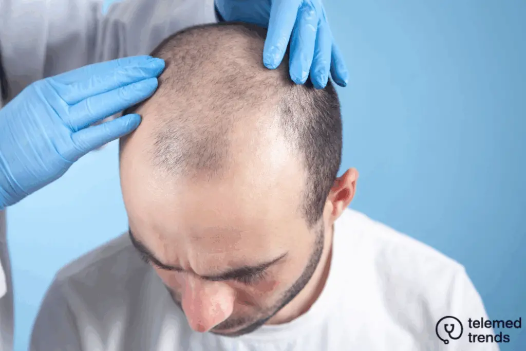 patient with male pattern baldness